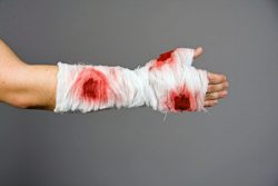 Krperteile blutiger Handverband